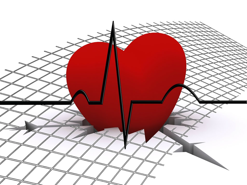 Electrocardiograma